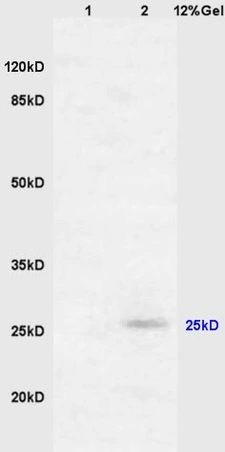 WB analysis of various samples using GTX51688 RASSF3 antibody. Dilution : 1:200 Lane 1 : mouse embryo lysates Lane 2 : mouse brain lysates