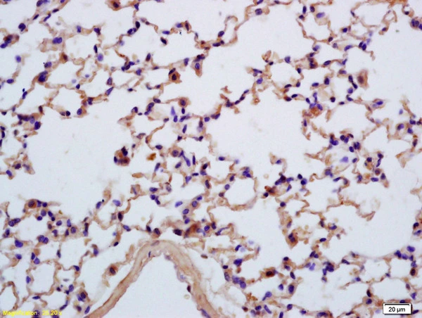IHC-P analysis of mouse lung tissue using GTX51696 SEZ6L antibody. Dilution : 1:200 IHC-P analysis of mouse lung tissue using GTX51696 SEZ6L antibody. Dilution : 1:200