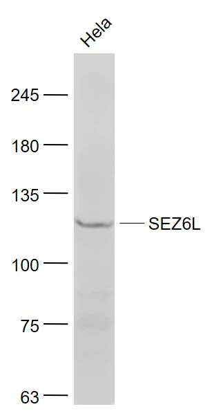 WB analysis of HeLa cell lysates using GTX51696 SEZ6L antibody. Dilution : 1:1000
