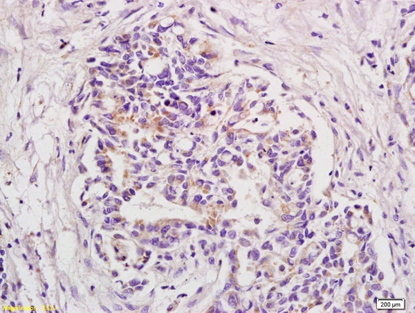IHC-P analysis of rat brain tissue using GTX51766 BOD1 antibody. Dilution : 1:200