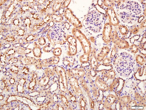 IHC-P analysis of rat kidney tissue using GTX51798 SIRT4 antibody. Antigen retrieval : Boiling in sodium citrate buffer (pH6) for 15min Dilution : 1:400 IHC-P analysis of rat kidney tissue using GTX51798 SIRT4 antibody. Antigen retrieval : Boiling in sodium citrate buffer (pH6) for 15min Dilution : 1:400