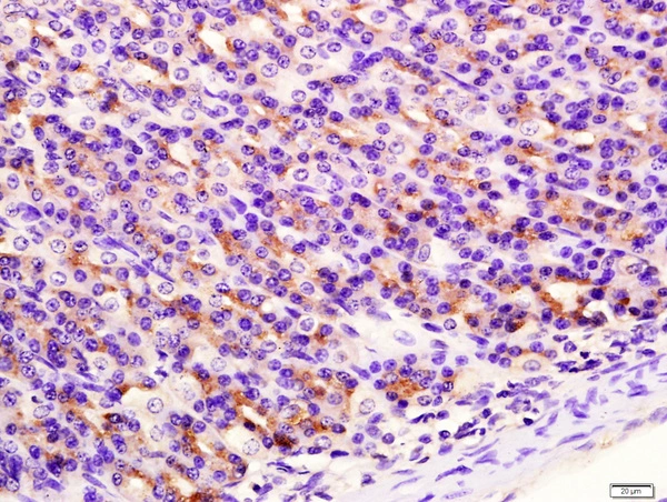 IHC-P analysis of rat stomach tissue using GTX51798 SIRT4 antibody. Antigen retrieval : Boiling in sodium citrate buffer (pH6) for 15min Dilution : 1:400