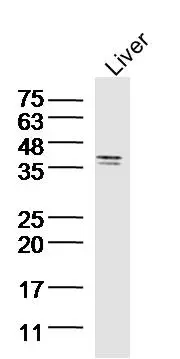 WB analysis of mouse liver tissue lysate using GTX51798 SIRT4 antibody. Dilution : 1:300
