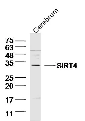 WB analysis of mouse cerebrum tissue lysate using GTX51798 SIRT4 antibody. Dilution : 1:300