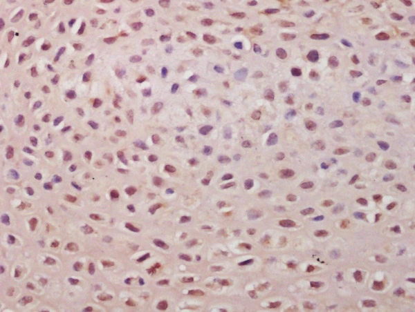 IHC-P analysis of mouse embryo tissue using GTX51813 TSPYL5 antibody. Dilution : 1:200