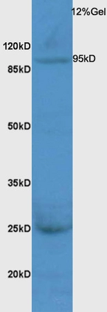 WB analysis of rat liver tissue lysate using GTX51836 TTK antibody. Dilution : 1:200