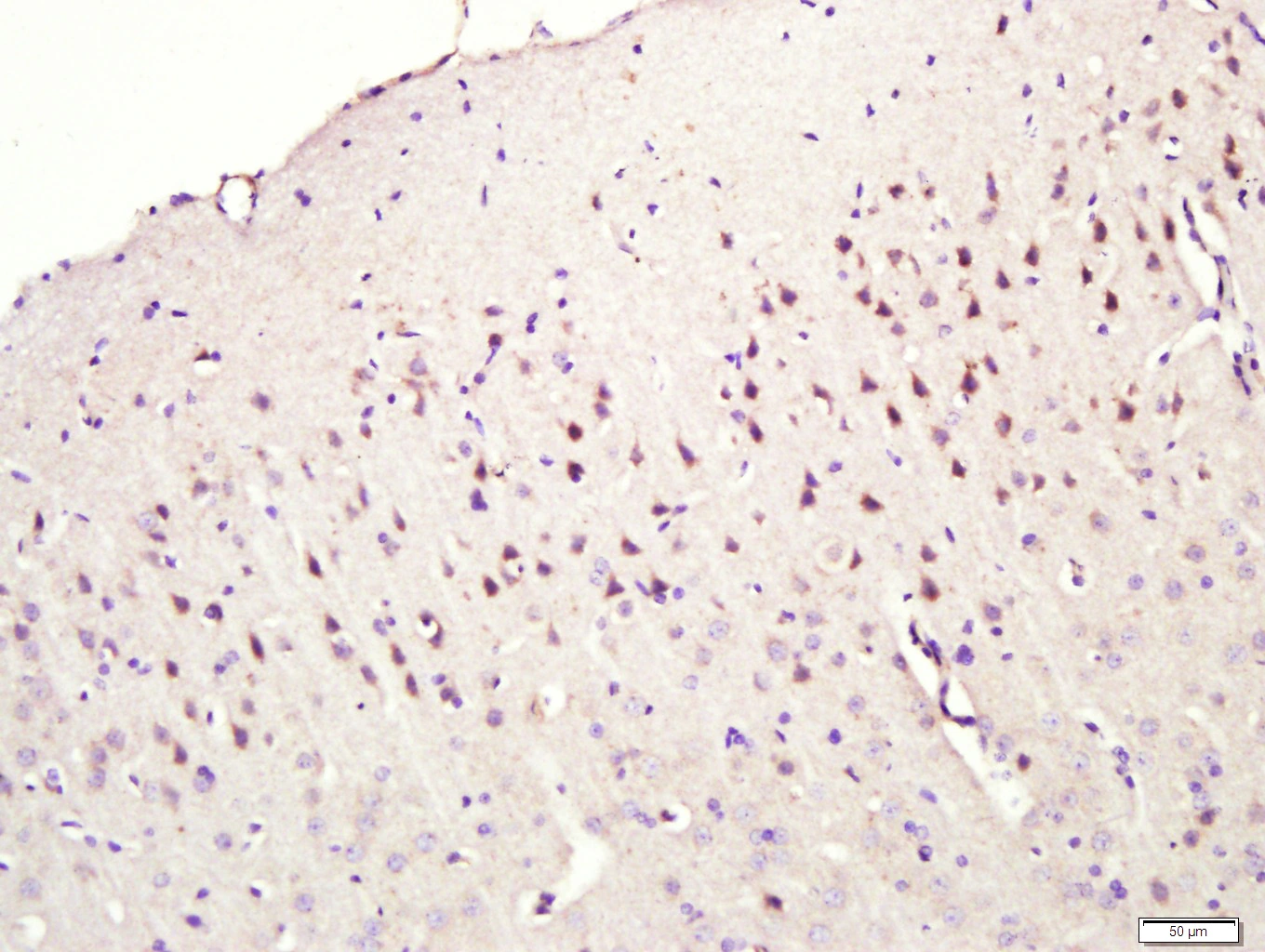 IHC-P analysis of rat brain tissue using GTX51857 CNIH3 antibody. Antigen retrieval : Boiling in sodium citrate buffer (pH6) for 15min Dilution : 1:400