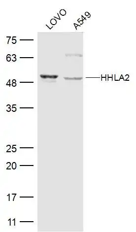 WB analysis of various samples using GTX51981 HHLA2 antibody. Dilution : 1:500 Lane 1 : Lovo cell lysates Lane 2 : A549 cell lysates