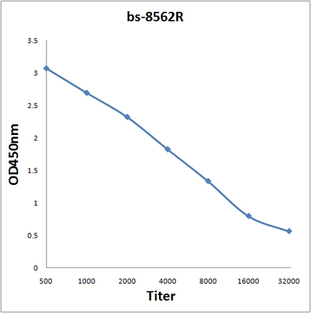 ELISA analysis of 0.2microg GTX52000 anitgen in 100microl buffer using serial diluted GTX52000 MLLT11 antibody. ELISA analysis of 0.2microg GTX52000 anitgen in 100microl buffer using serial diluted GTX52000 MLLT11 antibody.