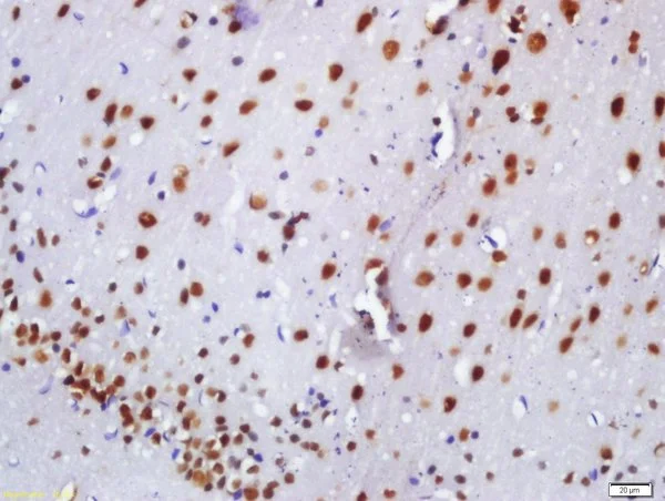 IHC-P analysis of rat brain tissue using GTX52007 BASP1 antibody. Dilution : 1:200