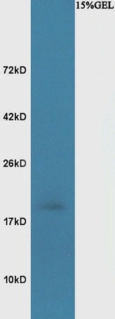 WB analysis of mouse brain tissue lysate using GTX52007 BASP1 antibody. Dilution : 1:200
