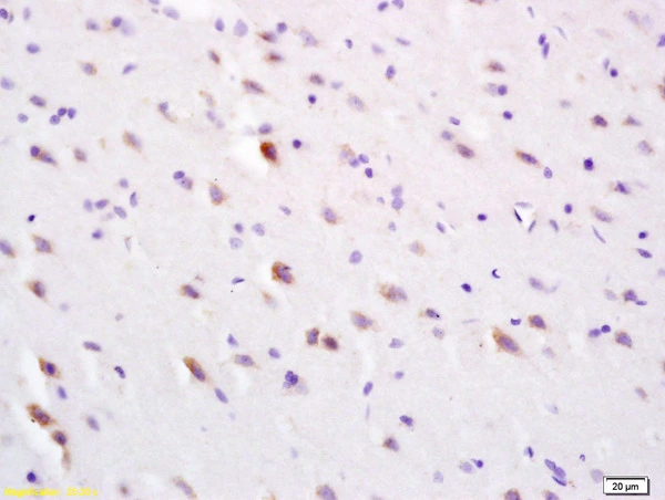 IHC-P analysis of rat brain tissue using GTX52009 SLC30A3 antibody. Dilution : 1:200 IHC-P analysis of rat brain tissue using GTX52009 SLC30A3 antibody. Dilution : 1:200