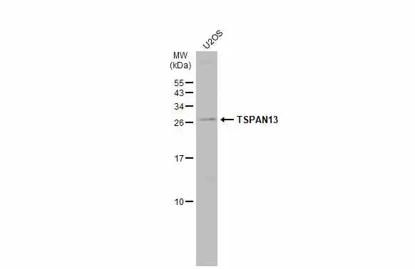 Whole cell extract (30 microg) was separated by 15% SDS-PAGE, and the membrane was blotted with TSPAN13 antibody (GTX52155) diluted at 1:500. The HRP-conjugated anti-rabbit IgG antibody (GTX213110-01) was used to detect the primary antibody, and the signal was developed with Trident ECL plus-Enhanced. Whole cell extract (30 microg) was separated by 15% SDS-PAGE, and the membrane was blotted with TSPAN13 antibody (GTX52155) diluted at 1:500. The HRP-conjugated anti-rabbit IgG antibody (GTX213110-01) was used to detect the primary antibody, and the signal was developed with Trident ECL plus-Enhanced.