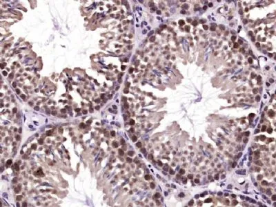IHC-P analysis of mouse testis tissue using GTX52193 SHARPIN antibody. Antigen retrieval : Boiling in sodium citrate buffer (pH6) for 15min Dilution : 1:400 IHC-P analysis of mouse testis tissue using GTX52193 SHARPIN antibody. Antigen retrieval : Boiling in sodium citrate buffer (pH6) for 15min Dilution : 1:400