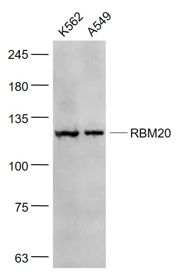 WB analysis of various samples using GTX52196 RBM20 antibody. Dilution : 1:1000 Lane 1 : K562 cell lysates Lane 2 : A549 cell lysates