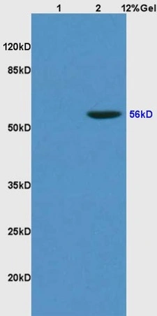 WB analysis of various samples using GTX52307 KLF4 antibody. Dilution : 1:200 Lane 1 : rat kidney lysates Lane 2 : human colon carcinoma lysates