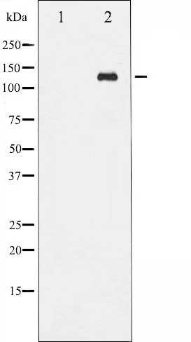 Western blot analysis of Abl phosphorylation expression in Adriamycin treated COS7 whole cell lysates,The lane on the left is treated with the antigen-specific peptide. Western blot analysis of Abl phosphorylation expression in Adriamycin treated COS7 whole cell lysates,The lane on the left is treated with the antigen-specific peptide.