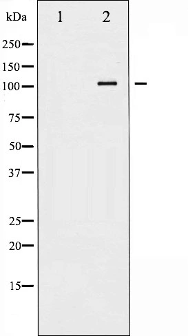 Western blot analysis of ATP1 alpha1/Na+K+ ATPase1 phosphorylation expression in Rat braintissue lysates,The lane on the left is treated with the antigen-specific peptide. Western blot analysis of ATP1 alpha1/Na+K+ ATPase1 phosphorylation expression in Rat braintissue lysates,The lane on the left is treated with the antigen-specific peptide.