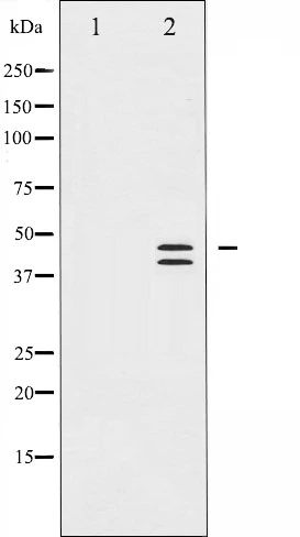 Western blot analysis of p44/42 MAP Kinase phosphorylation expression in EGF treated A431 whole cell lysates,The lane on the left is treated with the antigen-specific peptide. Western blot analysis of p44/42 MAP Kinase phosphorylation expression in EGF treated A431 whole cell lysates,The lane on the left is treated with the antigen-specific peptide.
