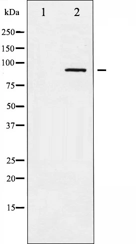 Western blot analysis of ADD1 phosphorylation expression in Forskolin treated HeLa whole cell lysates,The lane on the left is treated with the antigen-specific peptide. Western blot analysis of ADD1 phosphorylation expression in Forskolin treated HeLa whole cell lysates,The lane on the left is treated with the antigen-specific peptide.