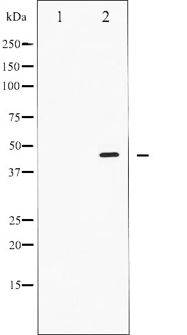 Western blot analysis of Smad2/3 phosphorylation expression in RAW264.7 whole cell lysates,The lane on the left is treated with the antigen-specific peptide. Western blot analysis of Smad2/3 phosphorylation expression in RAW264.7 whole cell lysates,The lane on the left is treated with the antigen-specific peptide.