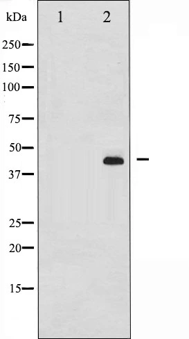 Western blot analysis of MEK1/2 phosphorylation expression in PMA treated 293 whole cell lysates,The lane on the left is treated with the antigen-specific peptide. Western blot analysis of MEK1/2 phosphorylation expression in PMA treated 293 whole cell lysates,The lane on the left is treated with the antigen-specific peptide.