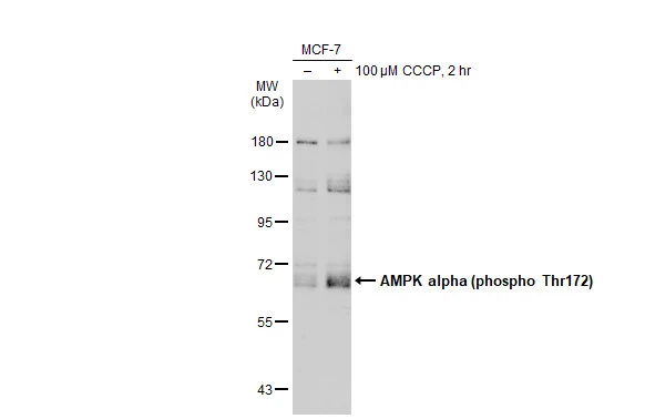 Untreated (-) and treated (+) MCF-7 whole cell extracts (30 microg) were separated by 7.5% SDS-PAGE, and the membrane was blotted with AMPK alpha 1 (phospho Thr183) + AMPK alpha 2 (phospho Thr172) antibody (GTX52341) diluted at 1:500. The HRP-conjugated anti-rabbit IgG antibody (GTX213110-01) was used to detect the primary antibody, and the signal was developed with Trident ECL plus-Enhanced. Untreated (-) and treated (+) MCF-7 whole cell extracts (30 microg) were separated by 7.5% SDS-PAGE, and the membrane was blotted with AMPK alpha 1 (phospho Thr183) + AMPK alpha 2 (phospho Thr172) antibody (GTX52341) diluted at 1:500. The HRP-conjugated anti-rabbit IgG antibody (GTX213110-01) was used to detect the primary antibody, and the signal was developed with Trident ECL plus-Enhanced.