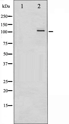 Western blot analysis of PKC mu phosphorylation expression in PMA treated A549 whole cell lysates,The lane on the left is treated with the antigen-specific peptide. Western blot analysis of PKC mu phosphorylation expression in PMA treated A549 whole cell lysates,The lane on the left is treated with the antigen-specific peptide.