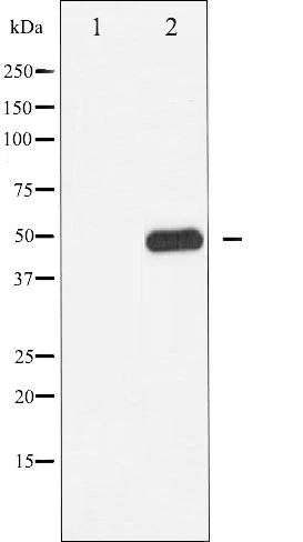 Western blot analysis of CaMK2 phosphorylation expression in K562 whole cell lysates,The lane on the left is treated with the antigen-specific peptide. Western blot analysis of CaMK2 phosphorylation expression in K562 whole cell lysates,The lane on the left is treated with the antigen-specific peptide.