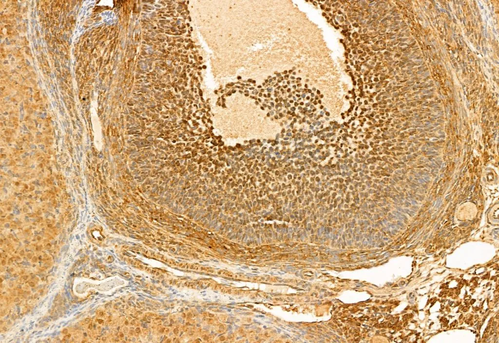 IHC-P analysis of rat ovary tissue using GTX52358 AHR antibody. Antigen retreival : Heat mediated antigen retrieval was performed in citrate buffer Dilution : 1:100