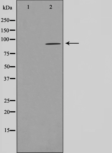 Western blot analysis of AhR expression in 293 whole cell lysates,The lane on the left is treated with the antigen-specific peptide.