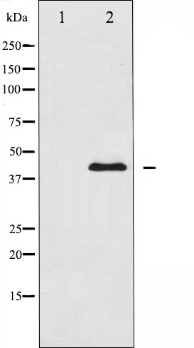 Western blot analysis of MEK1/2 expression in PMA treated HeLa whole cell lysates,The lane on the left is treated with the antigen-specific peptide. Western blot analysis of MEK1/2 expression in PMA treated HeLa whole cell lysates,The lane on the left is treated with the antigen-specific peptide.