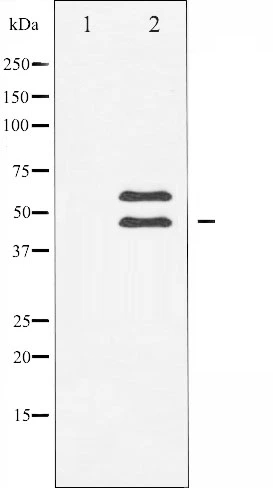 Western blot analysis of CaMK2-beta/gamma/delta expression in Rat braintissue lysates,The lane on the left is treated with the antigen-specific peptide. Western blot analysis of CaMK2-beta/gamma/delta expression in Rat braintissue lysates,The lane on the left is treated with the antigen-specific peptide.