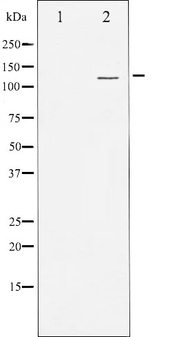 Western blot analysis of PKD1/2/3/PKC micro expression in Jurkat whole cell lysates,The lane on the left is treated with the antigen-specific peptide. Western blot analysis of PKD1/2/3/PKC micro expression in Jurkat whole cell lysates,The lane on the left is treated with the antigen-specific peptide.