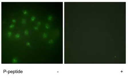 ICC/IF analysis of A549 cells using GTX52380 Vitamin D Receptor (phospho Ser208) antibody. ICC/IF analysis of A549 cells using GTX52380 Vitamin D Receptor (phospho Ser208) antibody.