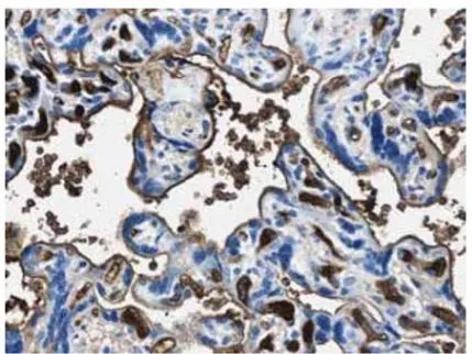 IHC-P analysis of formalin fixed human placenta tissue using GTX52386 EPO antibody. IHC-P analysis of formalin fixed human placenta tissue using GTX52386 EPO antibody.