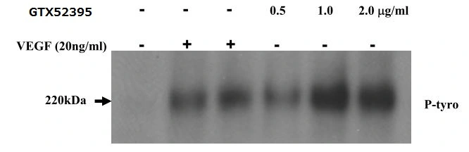 Activation assay analysis of HUVECs stimulated with 0.5, 1.0 and 2.0 ?g/ml GTX52395 VEGF Receptor 2 antibody or 20ng/ml VEGF for 30mins. The phospho-VEGFR2 was detected with IP-Western for P-Tyrosine.
