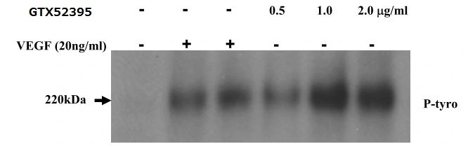 Activation assay analysis of HUVECs stimulated with 0.5, 1.0 and 2.0 microg/ml GTX52395 VEGF Receptor 2 antibody or 20ng/ml VEGF for 30mins. The phospho-VEGFR2 was detected with IP-Western for P-Tyrosine. Activation assay analysis of HUVECs stimulated with 0.5, 1.0 and 2.0 microg/ml GTX52395 VEGF Receptor 2 antibody or 20ng/ml VEGF for 30mins. The phospho-VEGFR2 was detected with IP-Western for P-Tyrosine.