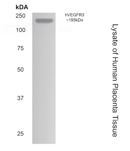 WB analysis of human placenta tissue using GTX52456 VEGF Receptor 3 antibody [7G63].