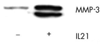 WB analysis of culture supernatant from human fibroblasts stimulated with or without 50ng/ml of IL-12 for 6 hours using GTX52474 MMP3 antibody [3E44].