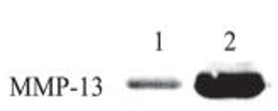 WB analysis of culture supernatant from human chondrocytes after treated without(1) and with(2) FGF2(100ng/ml) for24 hours using GTX52479 MMP13 antibody [12E10].
