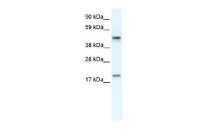 WB analysis of Jurkat cells using GTX52831 PDCD4 antibody at 0.2-1microg/ml. WB analysis of Jurkat cells using GTX52831 PDCD4 antibody at 0.2-1microg/ml.
