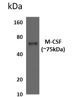 WB analysis of HEK293 expressing human M-CSF using GTX52921 M-CSF antibody [3V17].