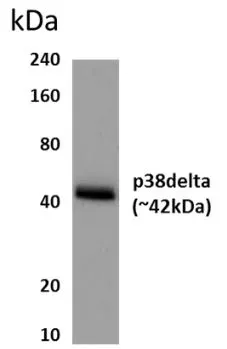 WB analysis of HepG2 cell lysate using GTX52959 SAPK4 antibody [8J21].