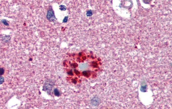 IHC-P analysis of human brain tissue using GTX52981 TCF21 antibody at 5.0microg/ml. IHC-P analysis of human brain tissue using GTX52981 TCF21 antibody at 5.0microg/ml.