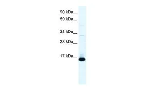 WB analysis of human fetal lung tissue using GTX52981 TCF21 antibody at 0.2-1microg/ml.