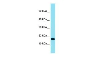 WB analysis of HeLa cells using GTX52981 TCF21 antibody at 1.0microg/ml.