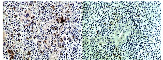 IHC-P analysis of formalin fixed mouse spleen tissue section using GTX53130 CD40L / CD154 antibody [MAB0712]. Left panel : Red Pulp Right panel : White Pulp