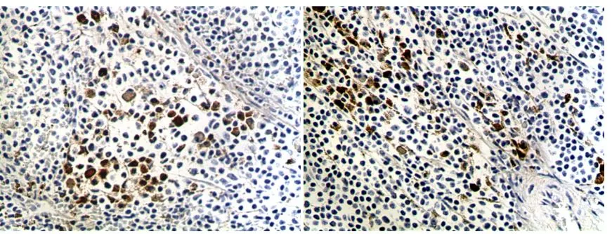 IHC-P analysis of formalin fixed mouse spleen tissue section using GTX53131 CD80 antibody [MAB0713]. Left panel : Red Pulp Right panel : White Pulp