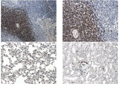 IHC-P analysis of 4% PFA fixed spleen (upper panel), lung (lower panel, left) and kidney (lower panel, right) tissue sections from LPS exposed mouse using GTX53155 GITR antibody [7C13].
